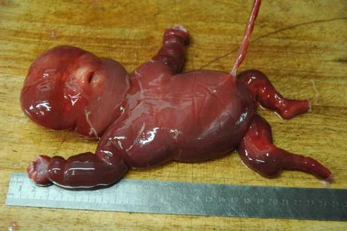 梦见生下死胎