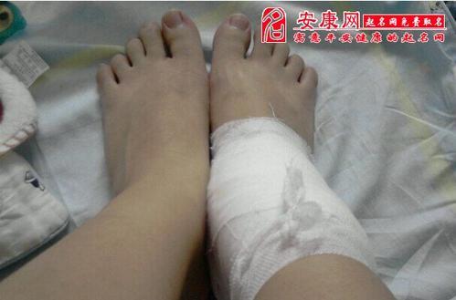 梦见绷带