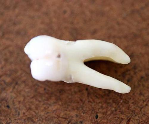 梦见上厕所没纸结果用手