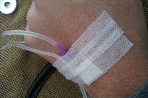 梦见扎针出血 梦见扎针出血