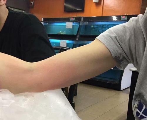 梦见缝短裤 梦见缝短裤