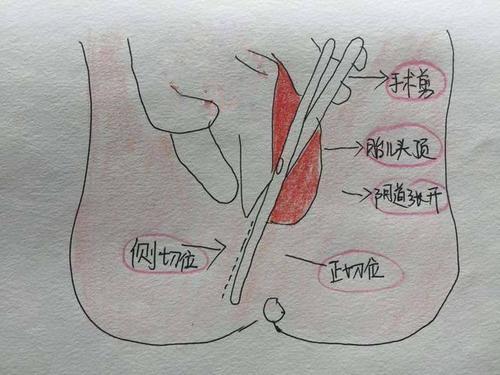 孕妇梦见缝衣服
