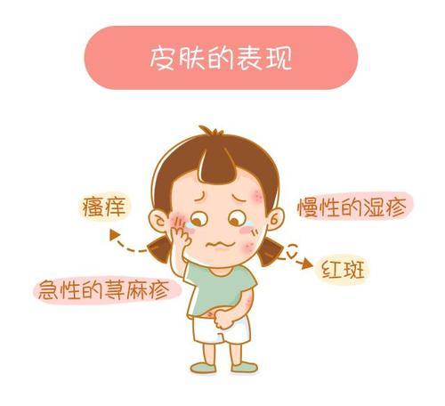 梦见过敏