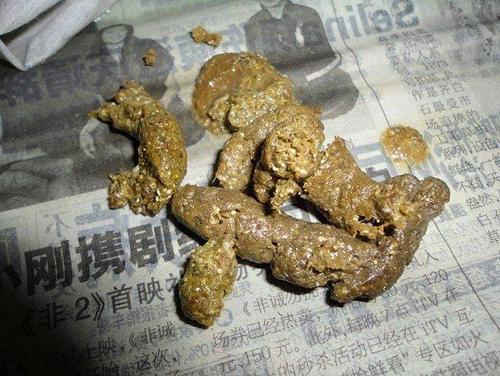 梦见恶心