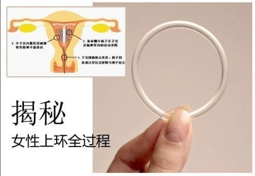 梦见环