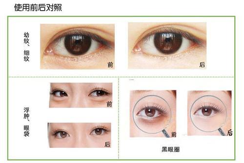 梦见眼睛肿了 梦见眼睛肿了
