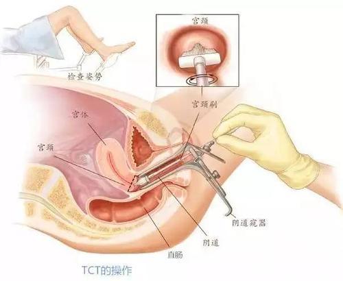 梦见自己妇科检查