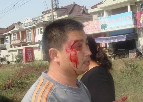 梦见自己拿刀砍人