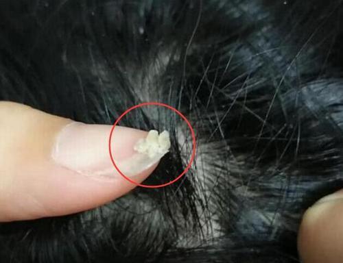 梦见用手抓大便