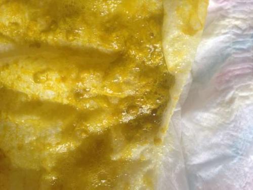 梦见自己拉很多稀屎