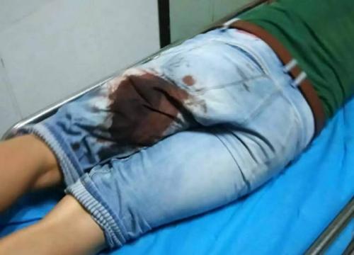 梦见自己被人拿刀捅 梦见自己被人拿刀捅