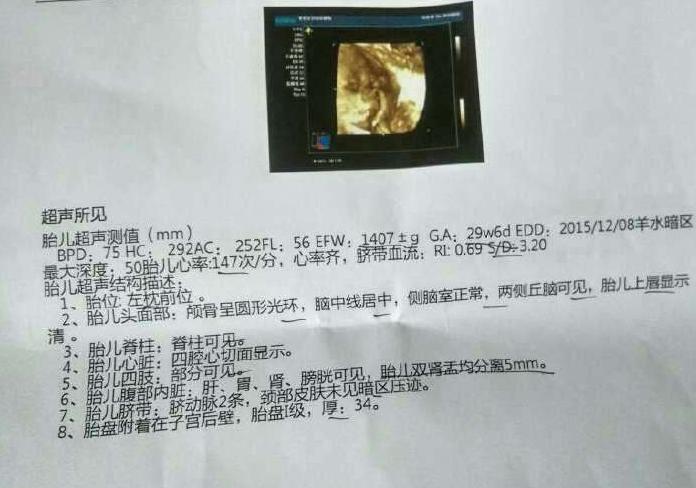 梦见别人怀孕是什么意思