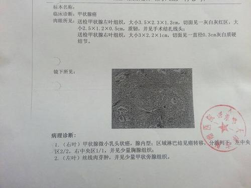 梦见朋友生癌症