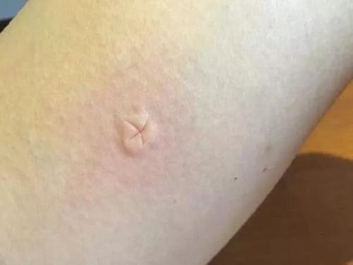 梦见被鬼咬手