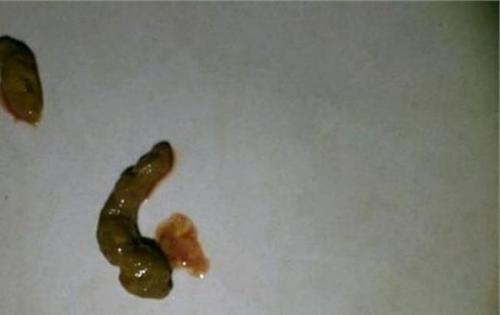 梦见拉大便不冲水
