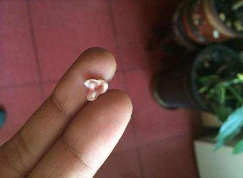 梦见牙掉