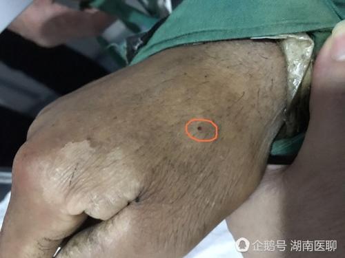 梦见右手被染黑了