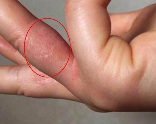 梦见手上被划破了 梦见手上被划破了