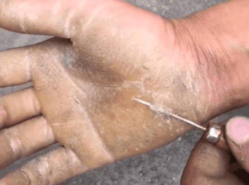 梦见针扎到手上