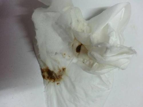 梦见吐了好多东西 梦见吐了好多东西