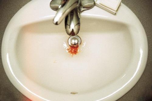 梦见自己咳血 梦见自己咳血