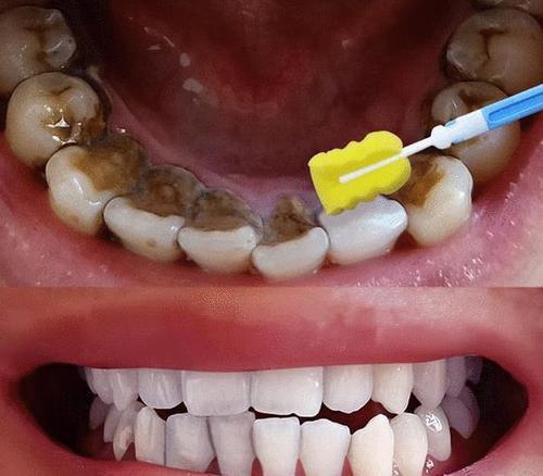 梦见牙齿掉到水里