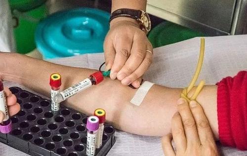 梦见输水跑针 梦见输水跑针