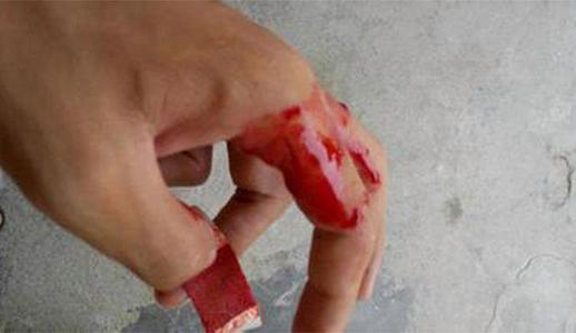 梦见脸上被刀割 梦见脸上被刀割