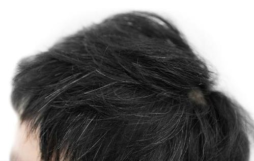 梦见别人白头发