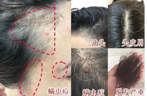 梦见鬼剥人的头皮