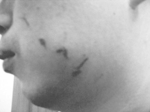 梦见针扎到舌头 梦见针扎到舌头