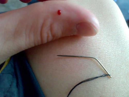 梦见有人拿针扎我 梦见有人拿针扎我