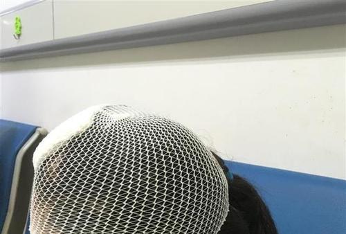 梦见头被砸了一个包 梦见头被砸了一个包