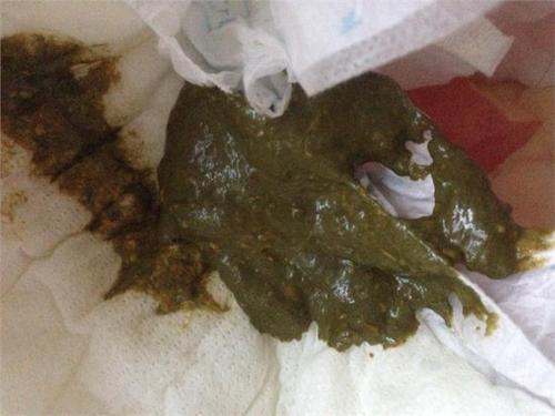 梦见粪便弄到身上 梦见粪便弄到身上