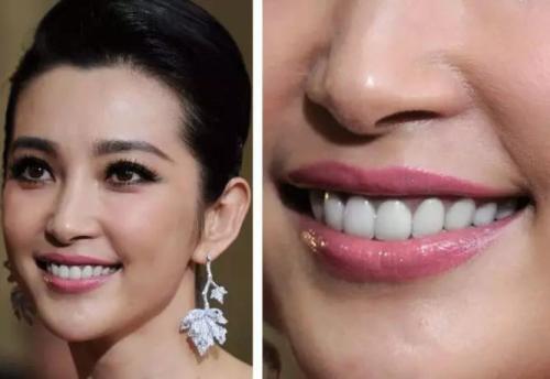 梦见掉了一颗假牙 梦见掉了一颗假牙