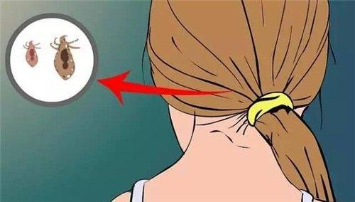 梦见头上生白虫