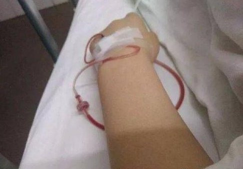 梦见输液回血